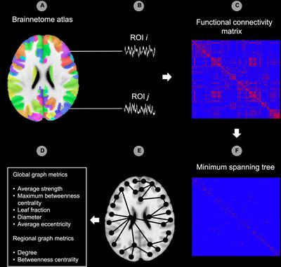 Spontaneous brain activity, graph metrics, and head motion related to prospective post-traumatic stress disorder trauma-focused therapy response